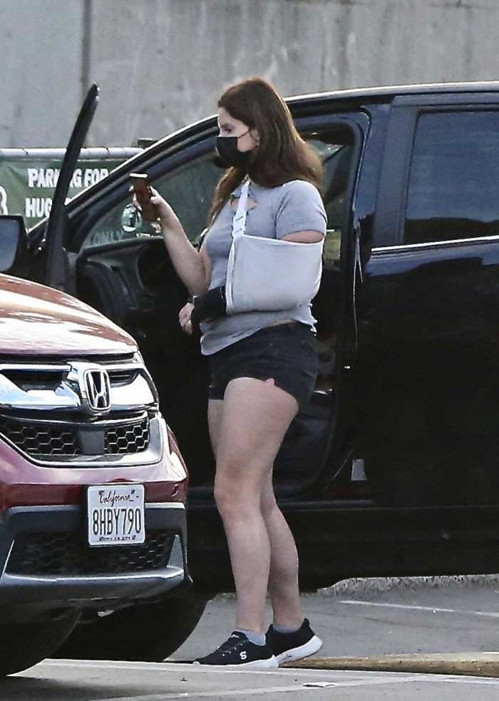 lana del rey goes out without her engagement ring and reveals how she fractured her arm 2